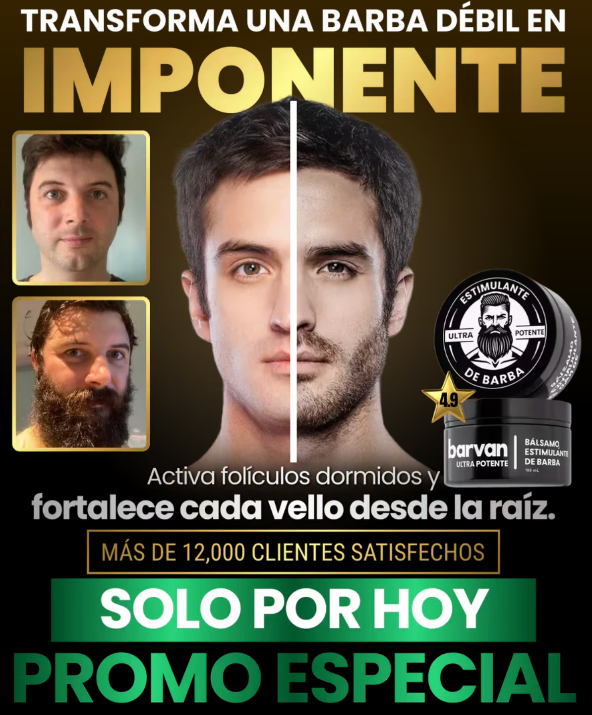 BARVAN™ - BÁLSAMO PARA CRECIMIENTO DE BARBA