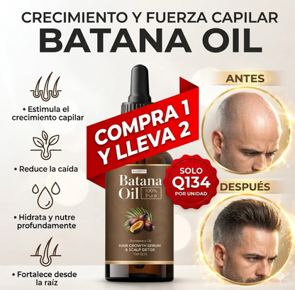 (SUPER 2X1) Shampoo Batana Oil