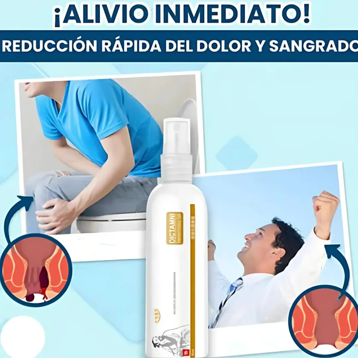 Dictamin - Alivia y reduce las hemorroides eficazmente