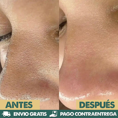 Dr. Melaxin Peel Shot | Elimina puntos negros